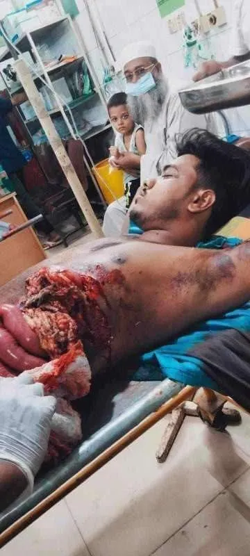 A brutal killing of students and protester occurred on July 18th, 2024, which the mainstream media, controlled by the autocratic government, is concealing. This violence was carried out by the police, RAB, BGB and the government's student wing (Awami Student League), under orders from the autocratic leader.